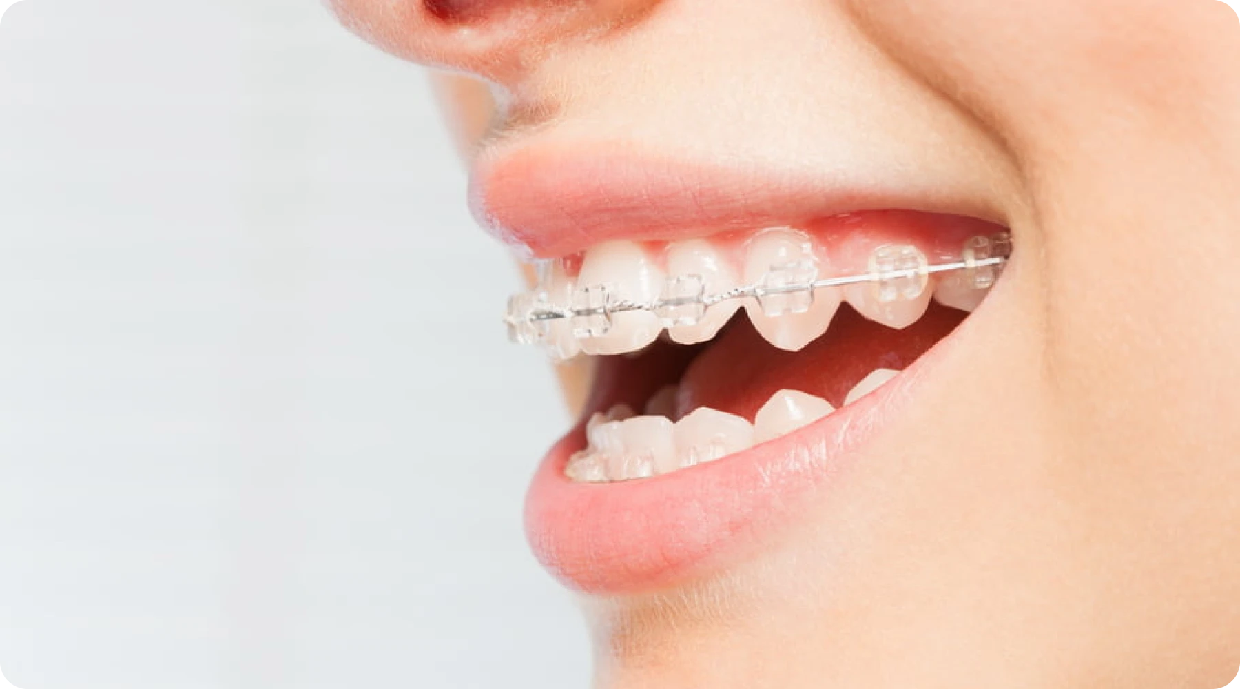 multi-bagues-ceramique